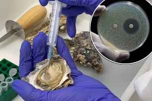 A scientists holds the shell of a fresh Sydney Rock Oyster. A close up of the protein in the blood, or hemolymph, of a Sydney Rock Oyster.